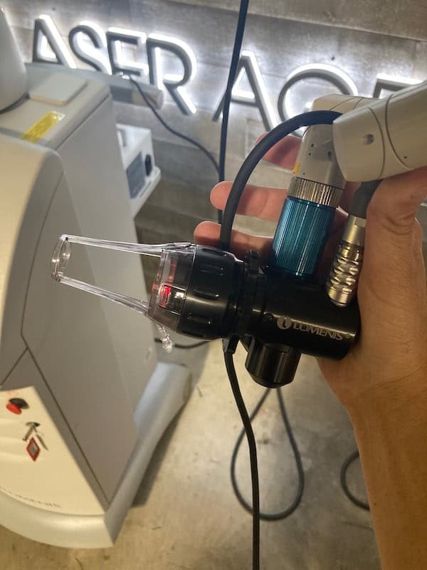 2010 Lumenis Ultrapulse - image 7