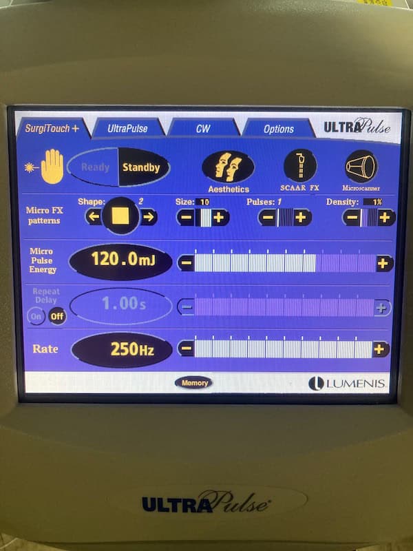 2010 Lumenis Ultrapulse - image 5