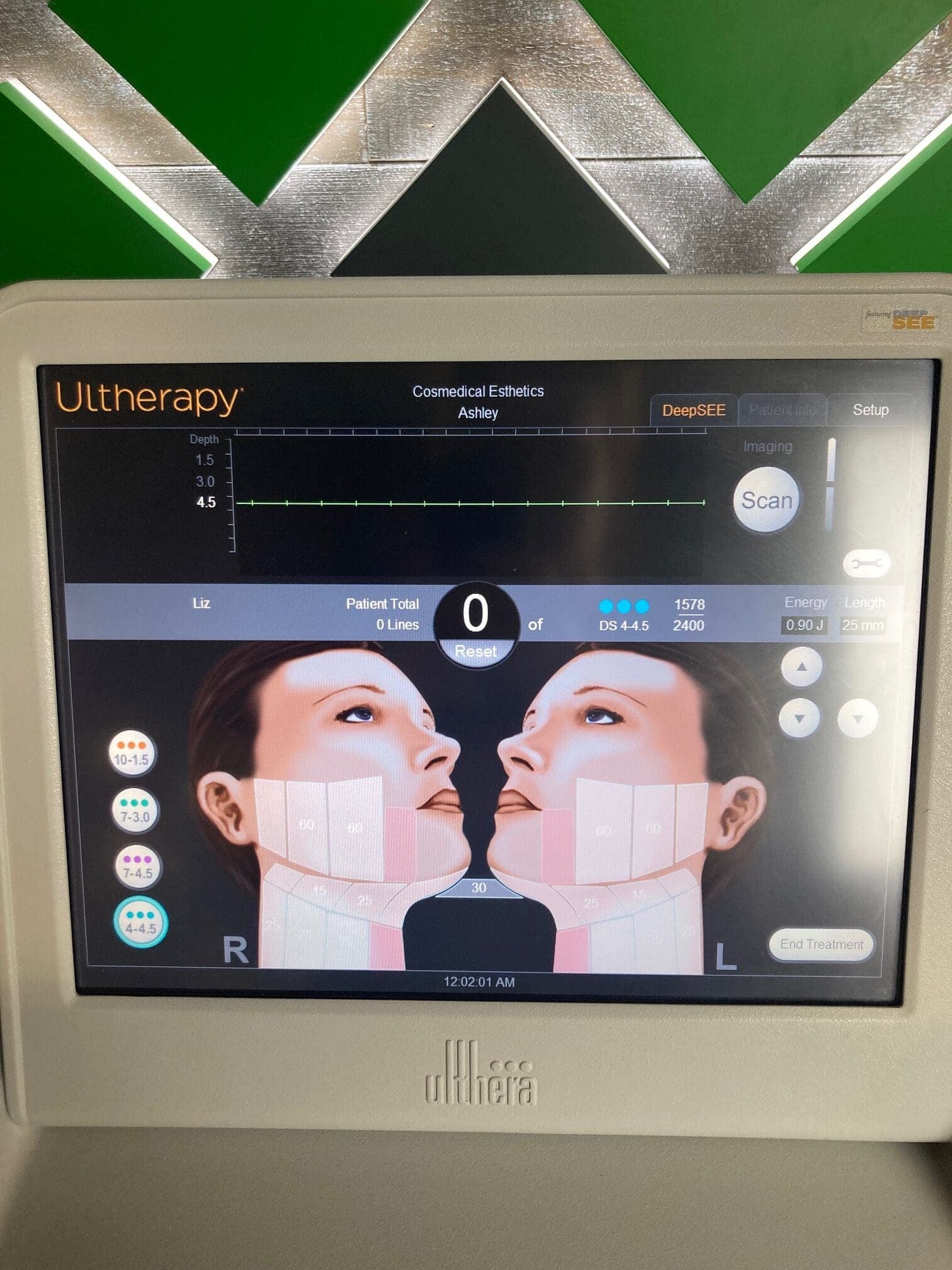 2015 Ulthera - image 5