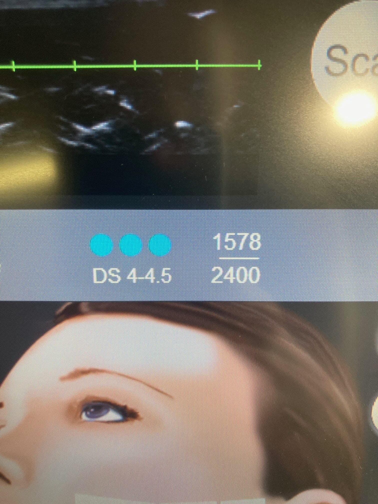 2015 Ulthera - image 7