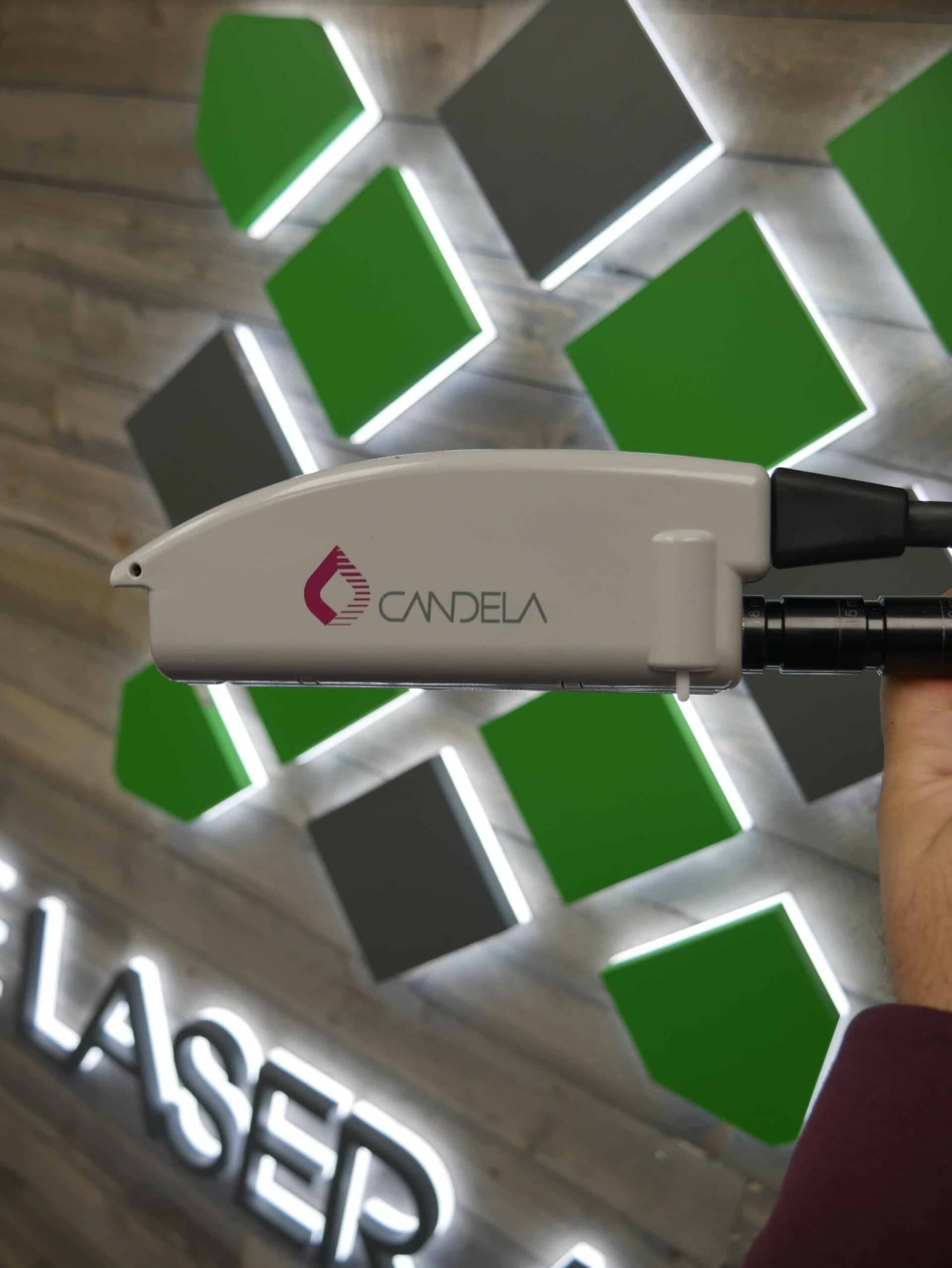 2005 Candela Mini GentleLase - image 6