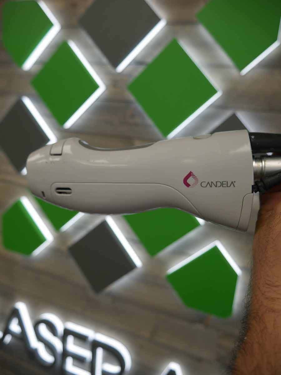 2013 Candela Gentlelase Pro-U - image 6