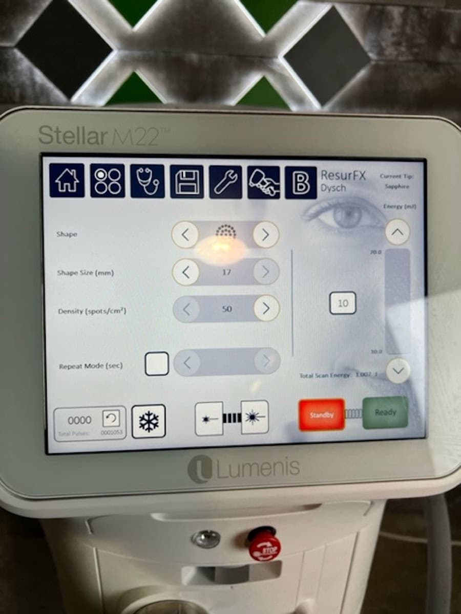 2022 Lumenis Stellar M22 - image 3