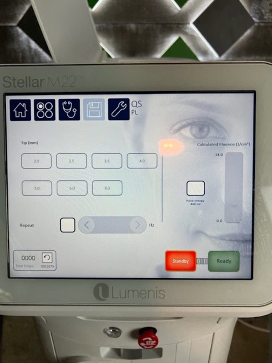 2022 Lumenis Stellar M22 - image 11