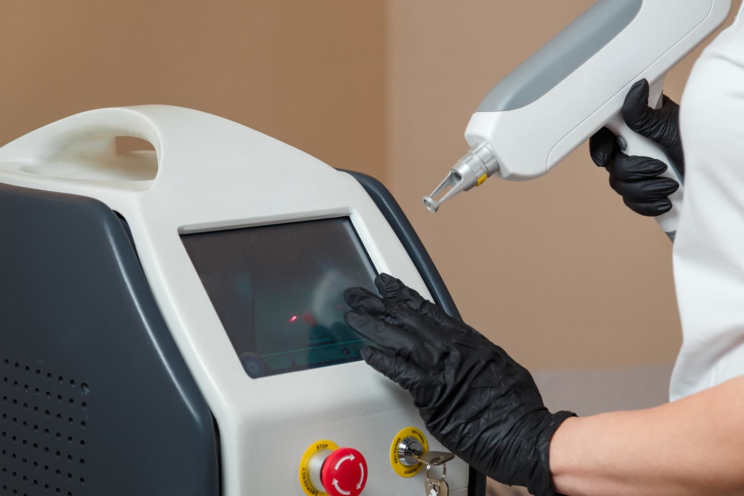 Factors to Consider When Choosing a Tattoo Removal Laser