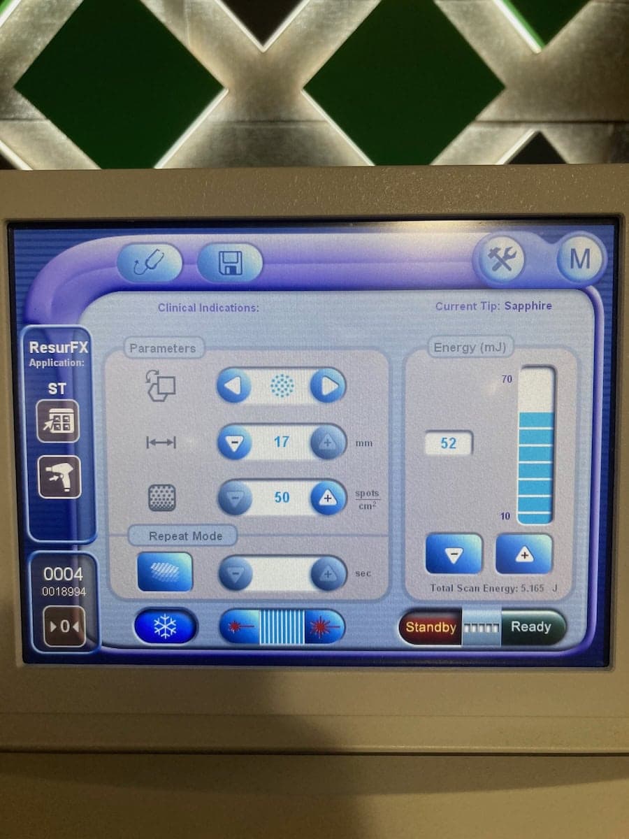 2012 Lumenis M22 - image 8