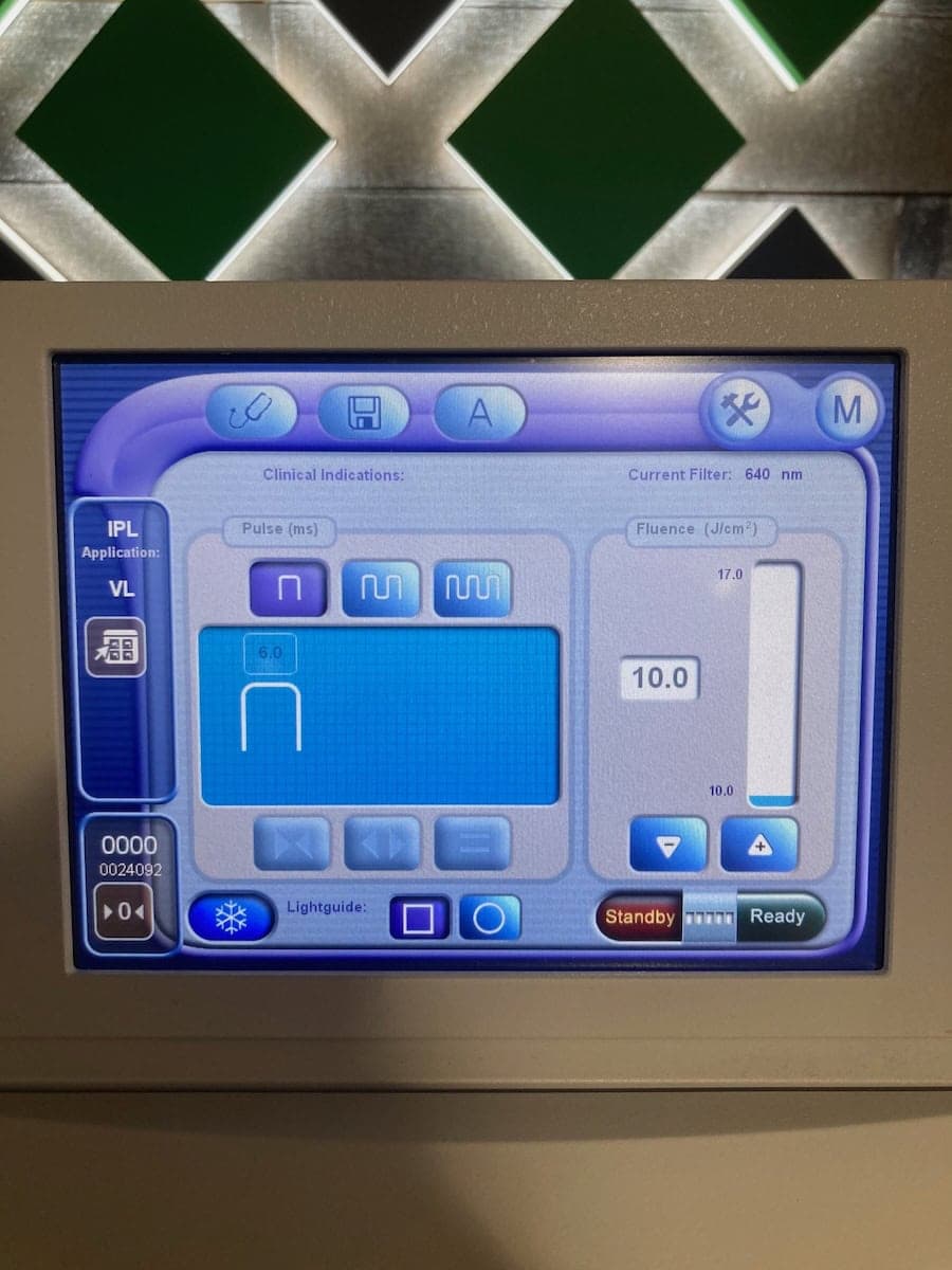 2012 Lumenis M22 - image 6