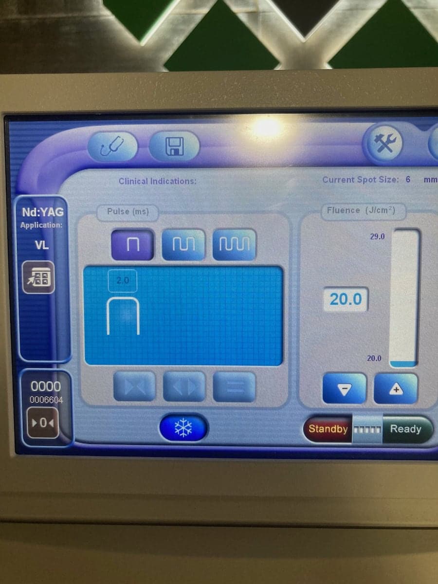 2012 Lumenis M22 - image 10