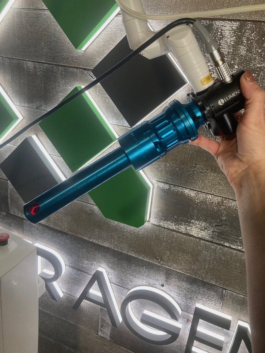 2017 Lumenis Acupulse - image 6