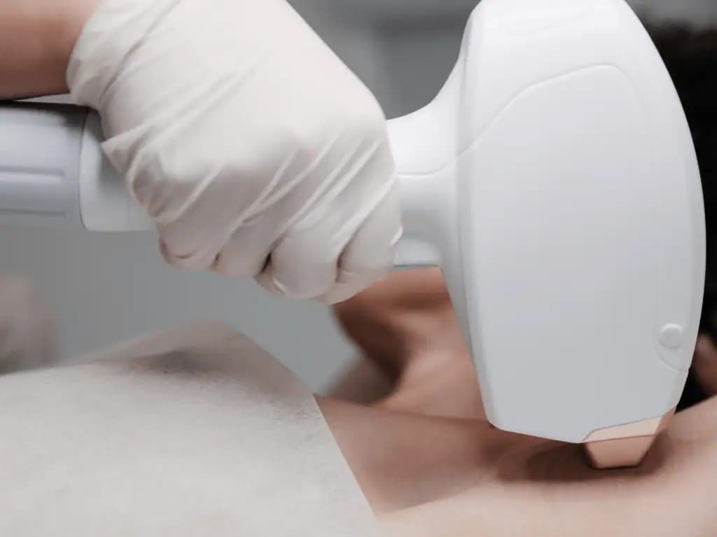 How to Increase Your Used Cosmetic Laser’s Resale Value